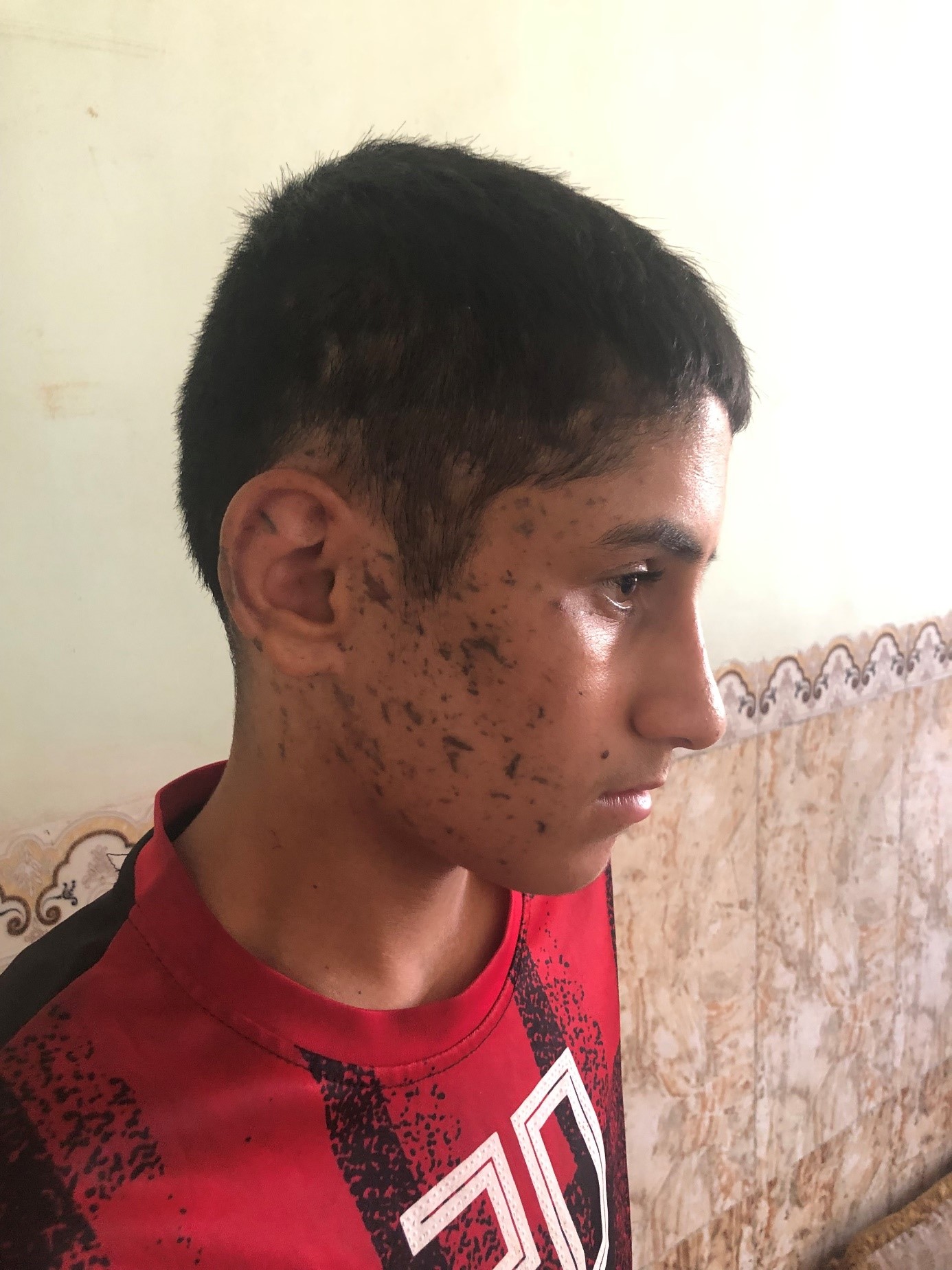 UN to investigate Turkish use of chemical weapons (Middle East Diplomatic – 9 Nov. 2022)